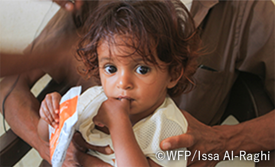 指を咥える子供